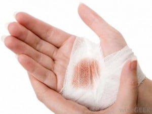 Wound Care in Home Care