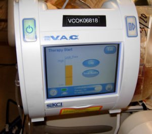 Wound Vac 18